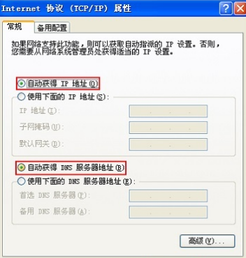 把电脑IP地址设置为自动获得